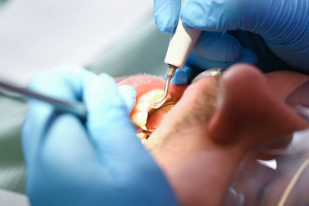 Best Emergency Broken Tooth Repair in Stroville, CA