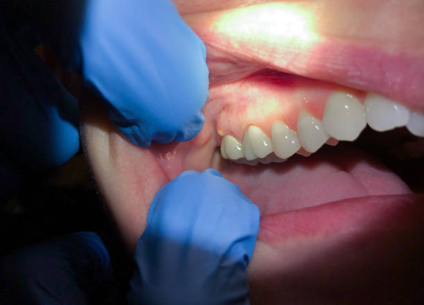 Best Emergency Orthodontic Repairs in Stroville, CA
