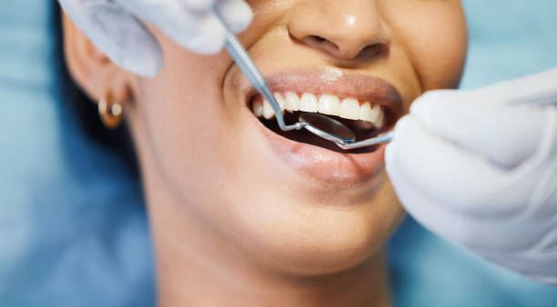 Best Emergency Wisdom Teeth Removal in Stroville, CA
