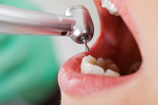 Best Emergency Treatment for Toothache in Stroville, CA